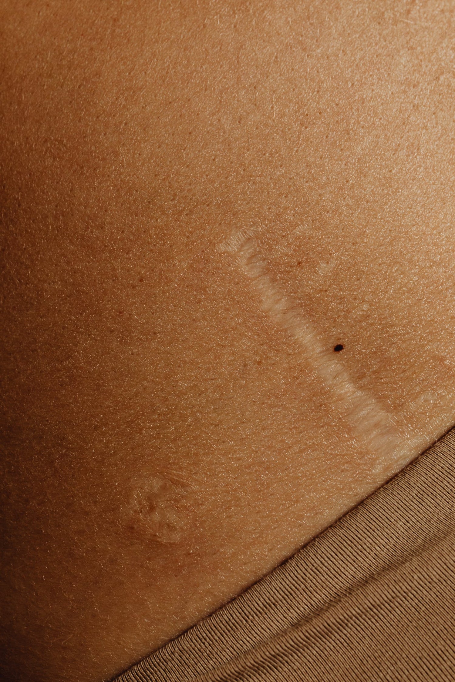 Anti inflammatoire et apaisante. image cicatrice.